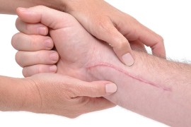 Motorisch-funktionell Motorisch-funktionell